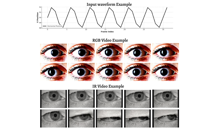 GenVOG-DiT qualitative RGB and infrared nystagmus video examples
