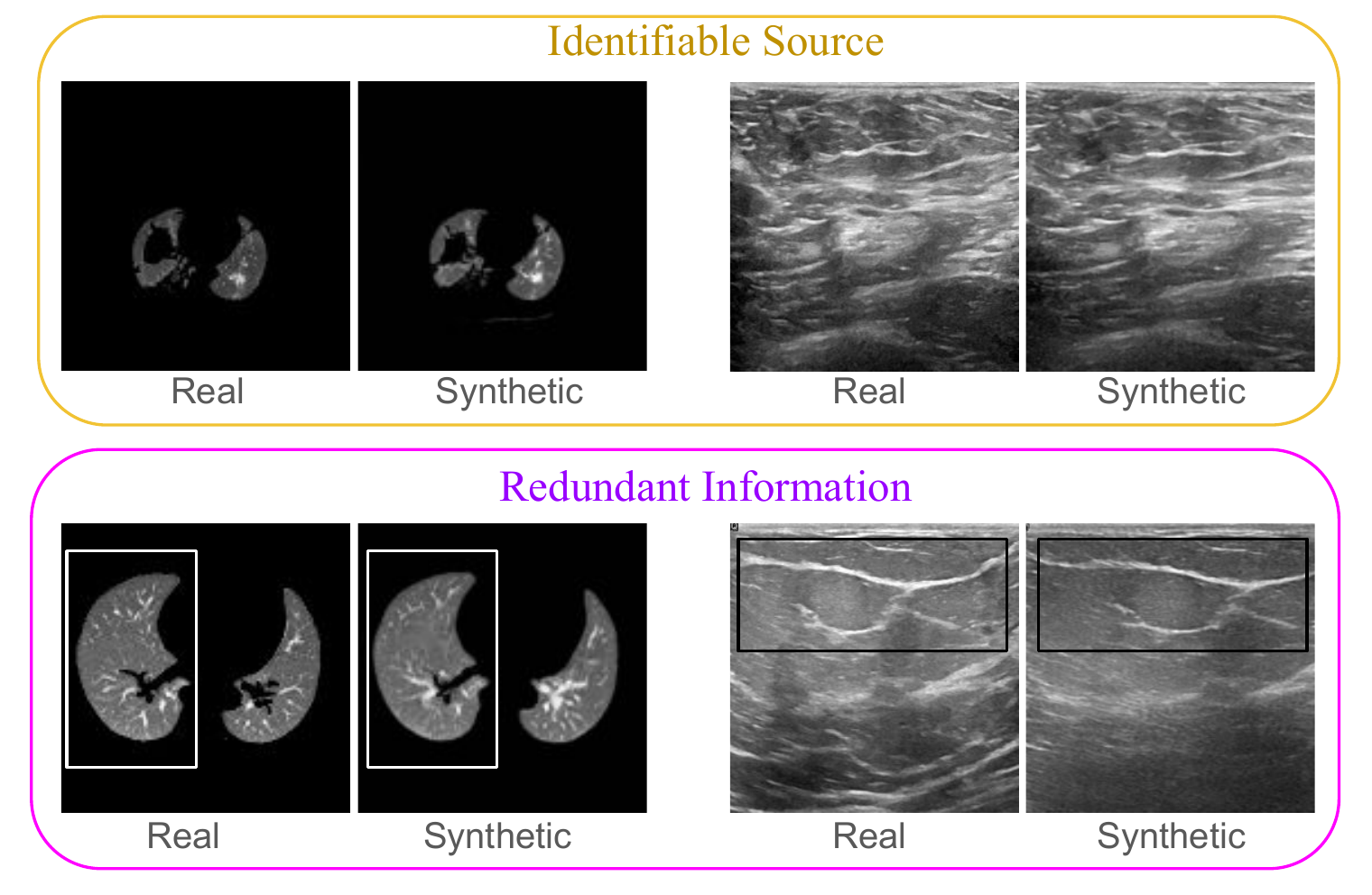 Real and synthetic CT and ultrasound examples showing identifiable-source and redundant-information replication