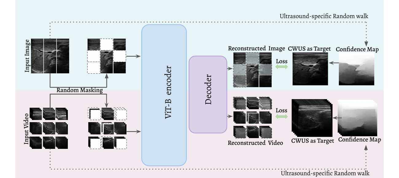 UltraMAE pre-training framework for ultrasound images and videos